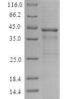 Recombinant Human C-X-C chemokine receptor type 4 (CXCR4) Protein - BioCrest Sci
