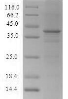 Recombinant Human Transcriptional repressor CTCF (CTCF), partial Protein - BioCrest Sci