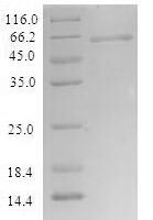 Recombinant Human Schlafen family member 12 (SLFN12) Protein - BioCrest Sci