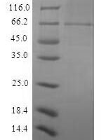 Recombinant Sindbis virus Structural polyprotein, partial Protein - BioCrest Sci