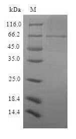 Recombinant Sindbis virus Structural polyprotein, partial Protein, Sindbis virus (SINV), in vitro E.coli expression system, N-terminal 10xHis-SUMO-tagged, 65.9kDa, purity >85% as determined by SDS-PAGE.