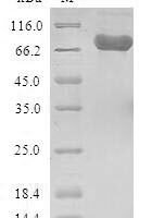 Recombinant Rat Dipeptidyl peptidase 4 (Dpp4),Partial Protein - BioCrest Sci