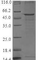 Recombinant Human C-C chemokine receptor type 6 (CCR6) Protein - BioCrest Sci