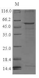 Recombinant Human C-C chemokine receptor type 6 (CCR6) Protein, Homo sapiens (Human), in vitro E.coli expression system, N-terminal 6xHis-SUMO-tagged, 58.5kDa, purity >85% as determined by SDS-PAGE.