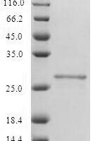 Recombinant Human T-lymphocyte activation antigen CD80 (CD80) Protein - BioCrest Sci