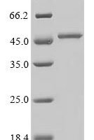 Recombinant Staphylococcus aureus Enterotoxin type I (SEI) Protein - BioCrest Sci