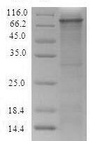 Recombinant Rat Integrin beta-4 (Itgb4), partial Protein - BioCrest Sci