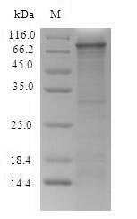 Recombinant Rat Integrin beta-4 (Itgb4), partial Protein, Rattus norvegicus (Rat), in vitro E.coli expression system, N-terminal 6xHis-SUMO-tagged, 92.2kDa, purity >85% as determined by SDS-PAGE.