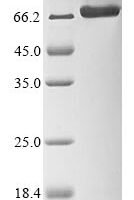 Recombinant Borna disease virus Envelope glycoprotein p57 (G), partial Protein - BioCrest Sci