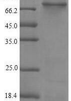 Recombinant Rat Integrin beta-4 (Itgb4), partial Protein - BioCrest Sci