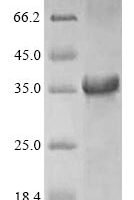 Recombinant Hevea brasiliensis Major latex allergen Hev b 5 Protein - BioCrest Sci