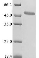 Recombinant Lampetra fluviatilis NADH-ubiquinone oxidoreductase chain 1 (MT-ND1) Protein - BioCrest Sci