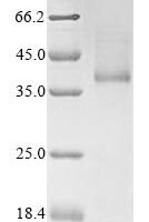 Recombinant Human Blood group Rh (D) polypeptide (RHD) Protein - BioCrest Sci