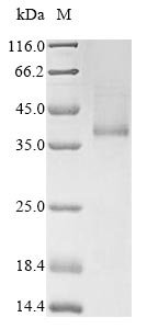 Recombinant Human Blood group Rh (D) polypeptide (RHD) Protein, Homo sapiens (Human), in vitro E.coli expression system, C-terminal 10xHis-tagged, 47.9kDa, purity >85% as determined by SDS-PAGE.