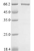 Recombinant Escherichia coli Colicin-E1 (cea) Protein - BioCrest Sci