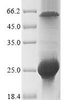Recombinan Rotavirus A Non-structural glycoprotein 4, partial Protein - BioCrest Sci