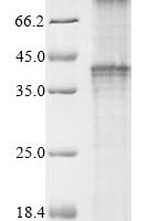 Recombinant Macaca mulatta Gonadotropin-releasing hormone II receptor (GNRHR2) (S367R, D373G) Protein - BioCrest Sci