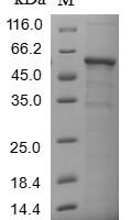 Recombinant Human Collagen alpha-3 (VI) chain (COL6A3), partial Protein - BioCrest Sci