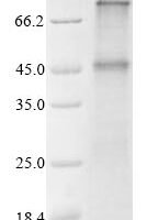 Recombinant Human Glucagon-like peptide 1 receptor (GLP1R) Protein - BioCrest Sci
