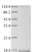 Recombinant African swine fever virus Virus attachment protein p12 (Pret-110) Protein - BioCrest Sci