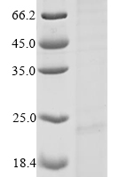Recombinant Mouse Reactive oxygen species modulator 1 (Romo1) Protein - BioCrest Sci
