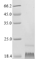 Recombinant Human Gamma-secretase subunit PEN-2 (PSENEN) Protein - BioCrest Sci