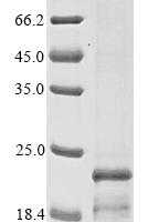 Recombinant African swine fever virus Major structural protein p17 (Ba71V-107) Protein - BioCrest Sci