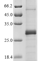 Recombinant Lassa virus Pre-glycoprotein polyprotein GP complex (GPC) Protein - BioCrest Sci