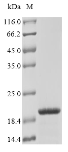 Recombinant Mouse Translocator protein (Tspo) Protein, Mus musculus (Mouse), in vitro E.coli expression system, N-terminal 10xHis-tagged, 21.7kDa, purity >85% as determined by SDS-PAGE.