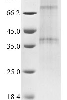 (Tris-Glycine gel) Discontinuous SDS-PAGE (reduced) with 5% enrichment gel and 15% separation gel.
