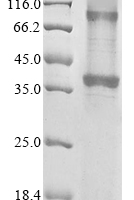 (Tris-Glycine gel) Discontinuous SDS-PAGE (reduced) with 5% enrichment gel and 15% separation gel.