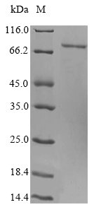 Recombinant Human Schlafen family member 12 (SLFN12) Protein, Homo sapiens (Human), in vitro E.coli expression system, N-terminal 6xHis-SUMO-tagged, 83.0kDa, purity >85% as determined by SDS-PAGE.