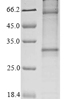 (Tris-Glycine gel) Discontinuous SDS-PAGE (reduced) with 5% enrichment gel and 15% separation gel.