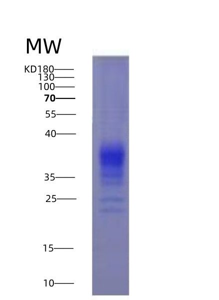 Recombinant Interleukin 17 (IL17), 293F cell, N-6His, 22&25kDa, purity >95% as determined by SDS-PAGE.