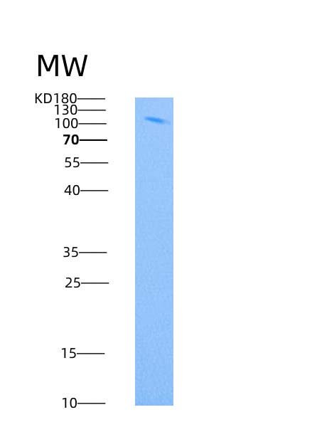 Recombinant Human Leptin Receptor / LEPR / CD295 Protein