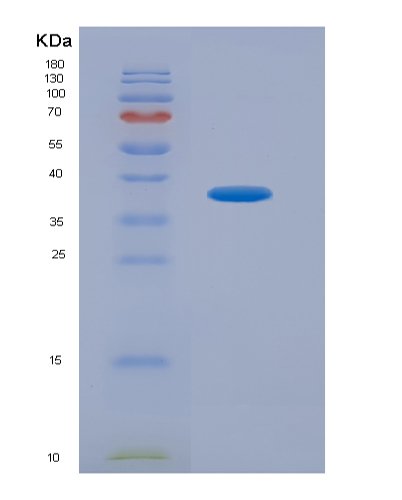 Eukaryotic Programmed Cell Death Protein 1 Ligand 1 (PDL1), HEK293 Cells, N-6His, 38kDa, purity >95% as determined by SDS-PAGE.
