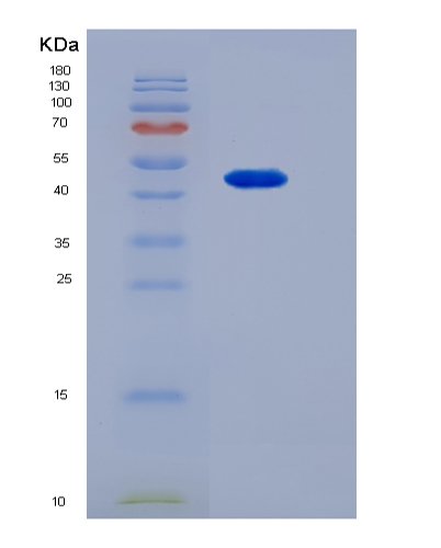 Eukaryotic Tumor Necrosis Factor Receptor Superfamily, Member 1B (TNFRSF1B)