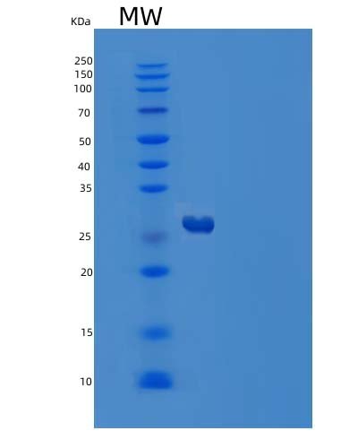 Recombinant Human Complement factor D Protein, HEK293 Cells, C-10His, 25.8 kDa, purity >95% as determined by SDS-PAGE.