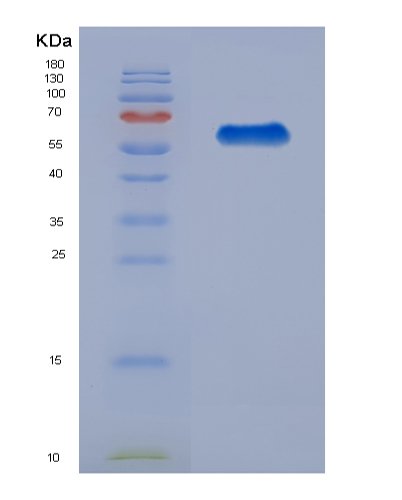 Recombinant Human Microtubule-Associated Protein Tau(MAPT), 293F cell, C-6His, 65 kDa, purity >90% as determined by SDS-PAGE.