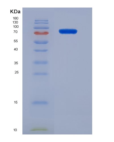 Recombinant Vascular Endothelial Growth Factor Receptor 2 SDS-PAGE gel analysis