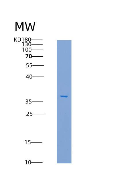 Recombinant Human IL1RL1 / ST2 Protein, HEK293 Cells, C-His, 36.5 kDa, purity >85% as determined by SDS-PAGE.