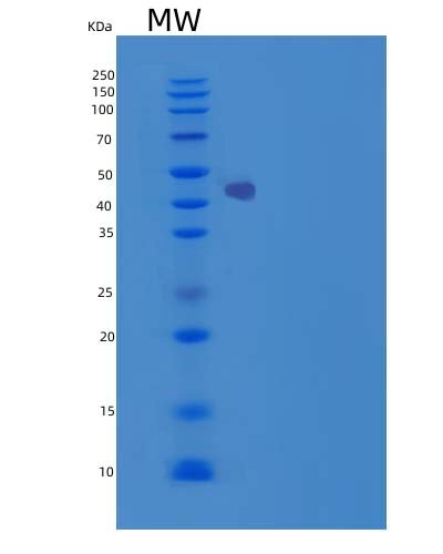Recombinant Human Carbonic Anhydrase IX / CA9 Protein, HEK293 Cells, C-His, 42.5 kDa, purity >90% as determined by SDS-PAGE.