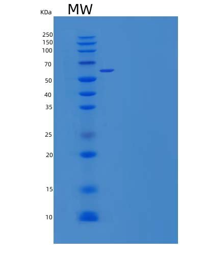 Recombinant Human Connective Tissue Growth Factor/CTGF/CCN2 Protein, HEK293 Cells, C-Fc, 62.6 kDa, purity >95% as determined by SDS-PAGE.