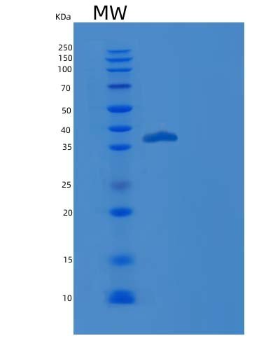 Recombinant Human TGFBR1 / ALK-5 / SKR4 Protein, HEK293 Cells, C-His & Fc, 38.8 kDa, purity >95% as determined by SDS-PAGE.