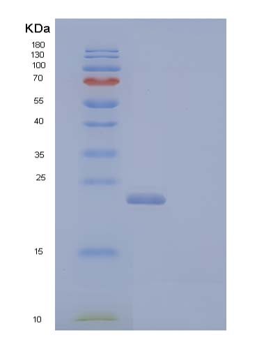 Recombinant Human Interleukin-4 Receptor Subunit Alpha/IL-4 Rα Protein