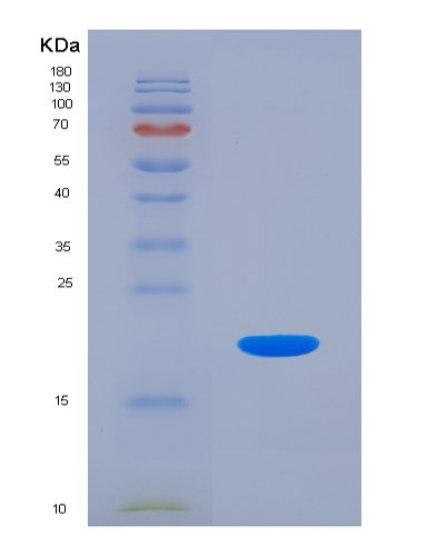 Eukaryotic Interleukin 18 (IL18), HEK293 Cells, N-6His, 18kDa, purity >95% as determined by SDS-PAGE.
