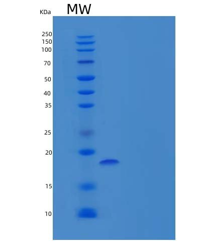 Recombinant Human Tumor Necrosis Factor Receptor II/TNFRSF1B/CD120b Protein