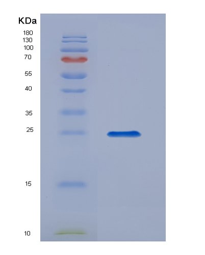 Eukaryotic Interleukin 17 (IL17), HEK293 Cells, N-6His, 25kDa, purity >95% as determined by SDS-PAGE.